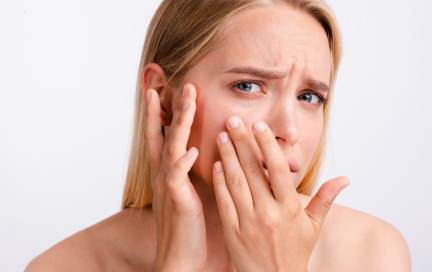 Секреты здоровой кожи: держим себорейный дерматит под контролем