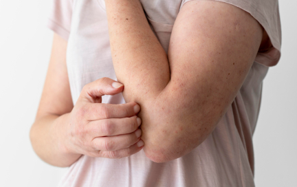 Чесотка у детей и взрослых: симптомы и лечение